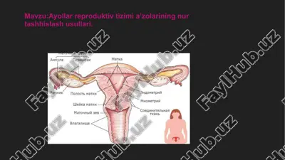 ayollar reproduktiv tizimi a’zolarining nur tashhislash usullari — PPTX