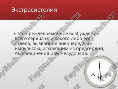 ekstrasistoliya — PPTX