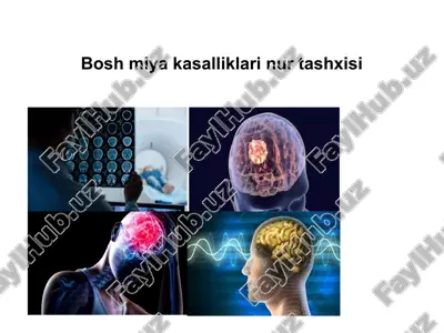 bosh miya kasalliklari nur tashxisi — PPTX