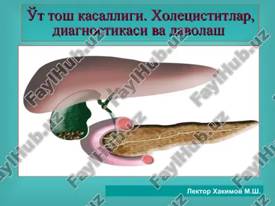 o't tosh kasalligi.xoletsistitlar, diagnostikasi va davolash — PPT