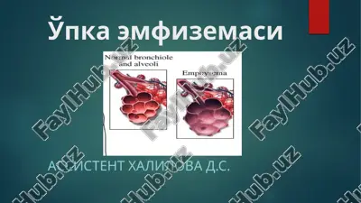 oʻpka emfizemasi — PPTX