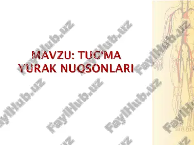 tug'ma yurak nuqsonlari — PPT