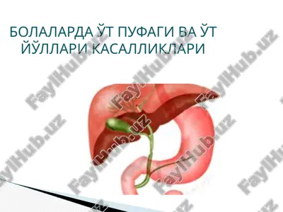 холецистит — PPTX