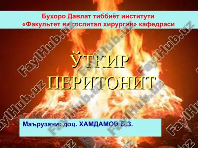 ўткир перитонит — PPT