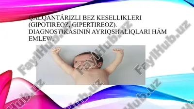 gipotireoz — PPTX