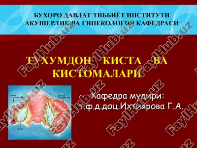 tuxumdon kista va kistomalari — PPT