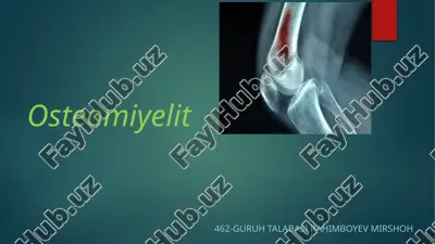 osteomiyelit — PPTX