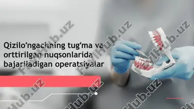 qizilo`ngachning tug`ma va ortirilgan nuqsonlarida bajariladigan operatsiyalar — PPTX