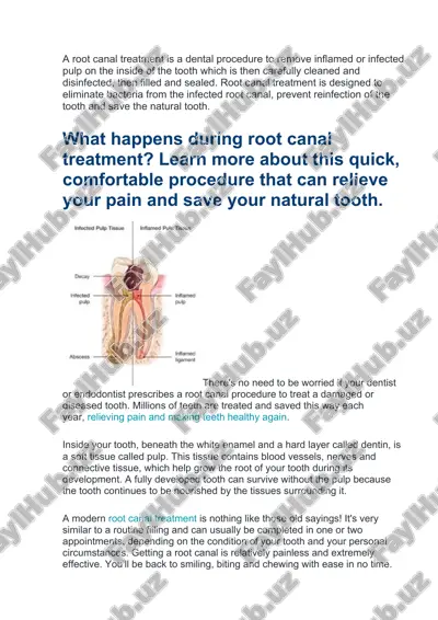 all about root canals — DOCX