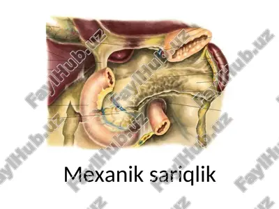 mexanik sariqlik — PPT