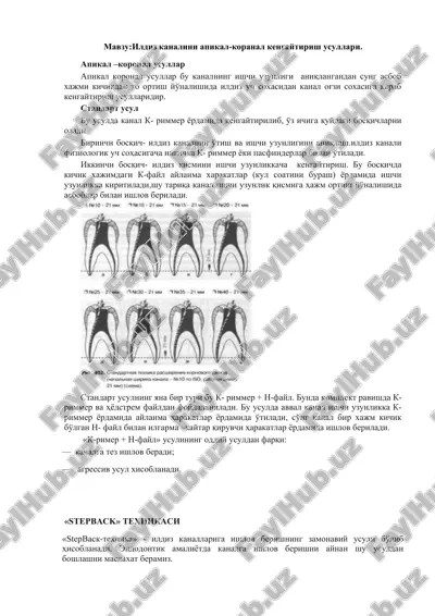 ildiz kanalini apikal-koranal kengaytirish usullari — DOC