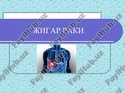 jigar raki — PDF
