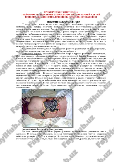 nekroticheskaya flegmona u detey — PDF