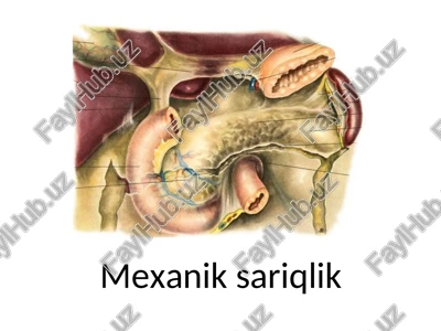 mexanik sariqlik — PPT