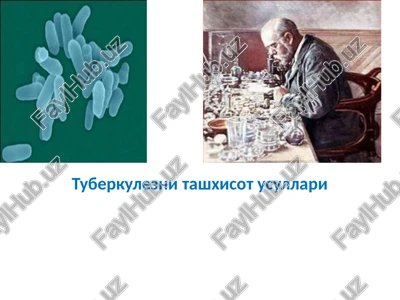 tuberkulezni tashhisot usullari — PPTX