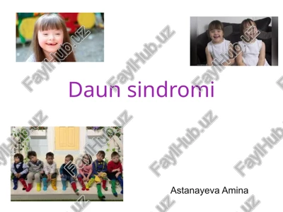 daun sindromi — PPTX