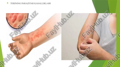 terining parazitar kasalliklari — PPTX