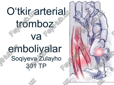 o‘tkir arterial tromboz va emboliyalar — PPT
