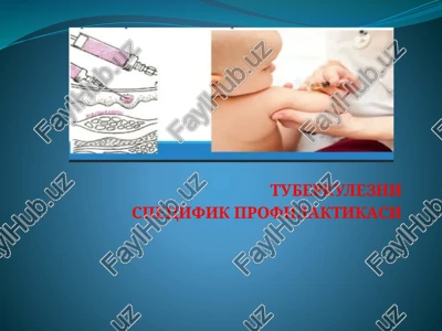 tuberkulezni spetsifik profilaktikasi — PPTX