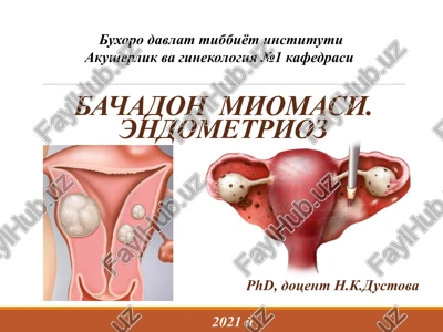 bachadon miomasi — PPT