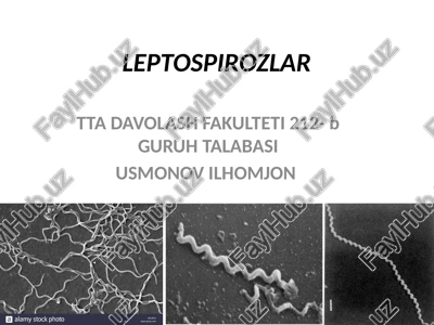leptospirozlar — PPTX