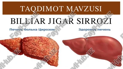 billiar jigar sirrozi — PDF