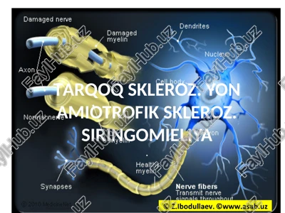 tarqoq skleroz — PPTX