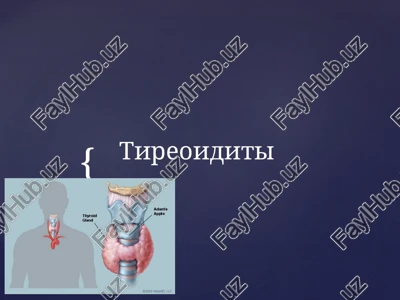 tireoiditi — PPTX
