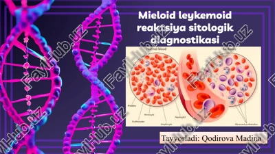 mieloid leykoidoid reaktsiya — PPTX