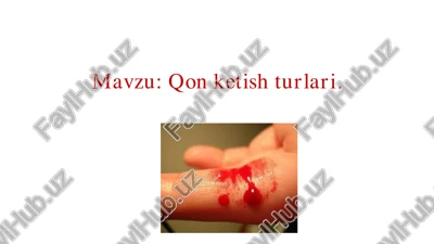 qon ketish turlari — PDF