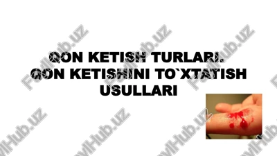 qon ketish turlari.qon ketishini to`xtatish usullari — PPTX