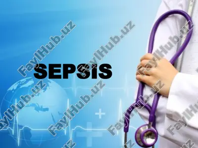 sepsis — PPTX
