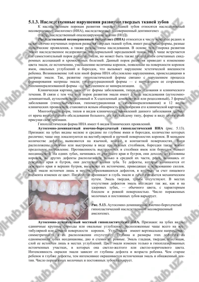 nasledstvennie narusheniya razvitiya tverdix tkaney zubov — DOC