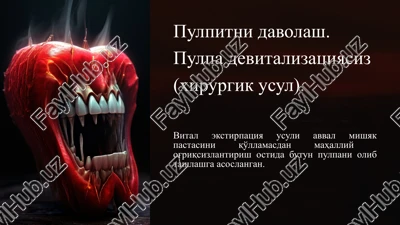 pulpitni davolash (xirurgik usul) — PPTX