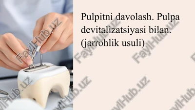 devitalizatsiyalovchi pasta — PPTX