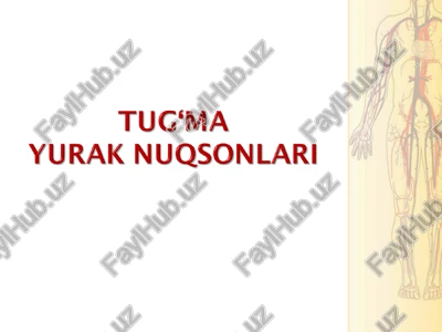 tug‘ma yurak nuqsonlari — PPT