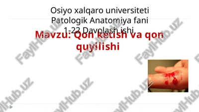 qonketish va qon quyilishi — PPTX