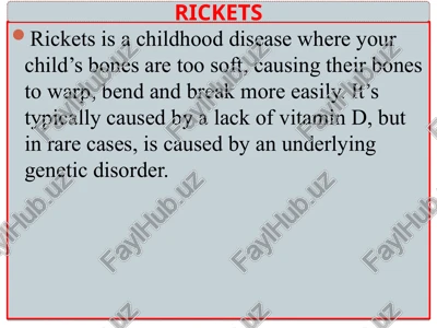 rickets — PPTX