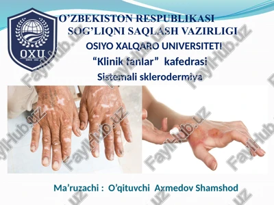 sistemalisklerodermiya — PPTX