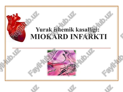 miokard infarkti — PPT