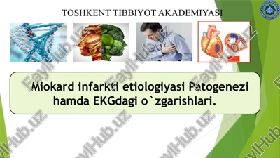 miokard infarkti etiologiyasi patogenezi hamda ekgdagi o`zgarishlari — PPTX