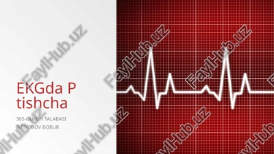 ekgdaptishcha — PPTX