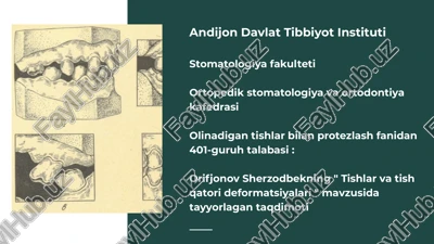 tish qatorlari deformatsiyalar — PPTX