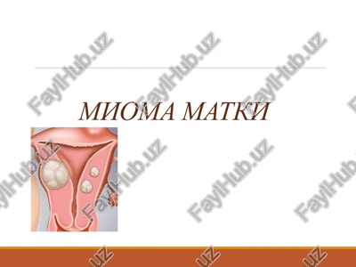 mioma matki,bachadon miomasi — PPTX