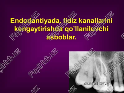endodontik asboblar parametrlari — PPTX