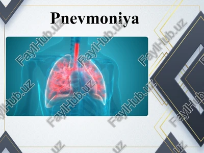pnevmoniya — PPT
