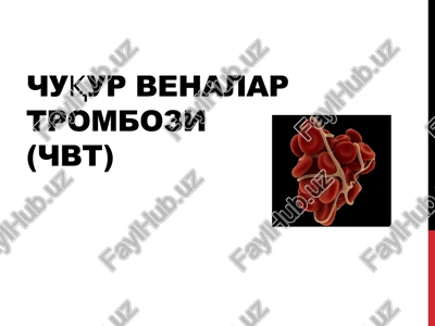 chuqur venalar trombozi(chvt) — PPTX