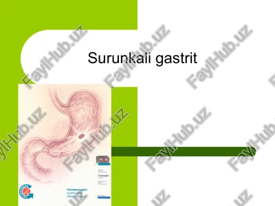 surunkali gastrit — PPTX
