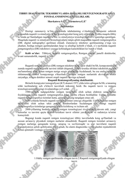 raqamli rentgenografiya (dr) — DOCX
