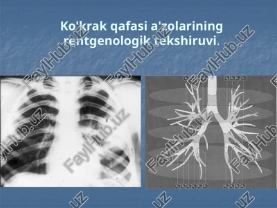 ko'krakqafasia'zolariningrentgenologiktekshiruvi — PPTX